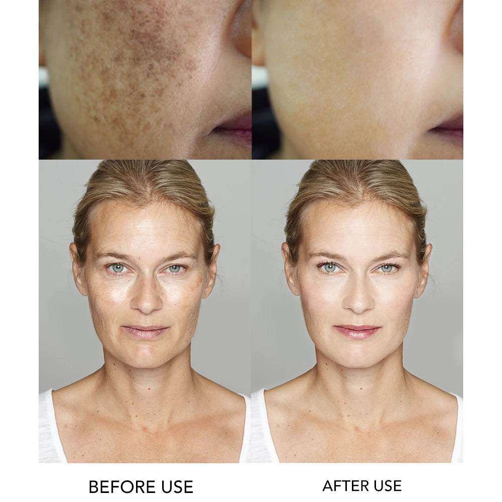 Whitening and Moisturizing Facial Cream