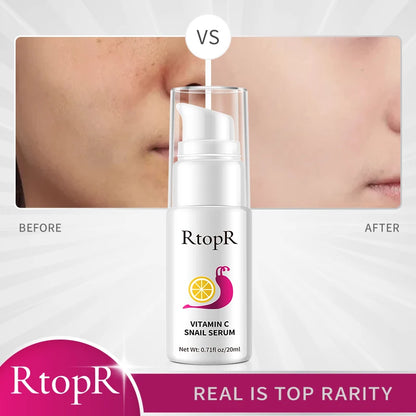 20ml Hyaluronic Vitamin-C Snail Serum