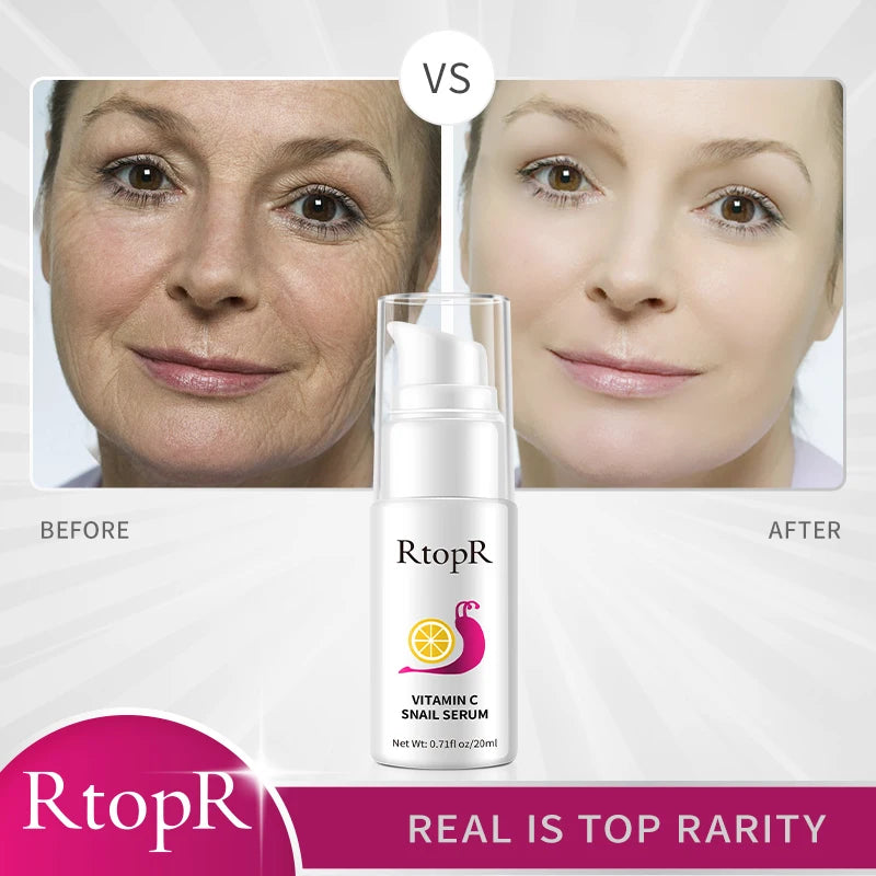 20ml Hyaluronic Vitamin-C Snail Serum