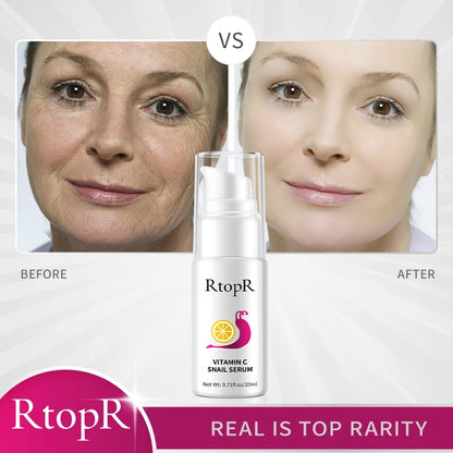 20ml Hyaluronic Vitamin-C Snail Serum
