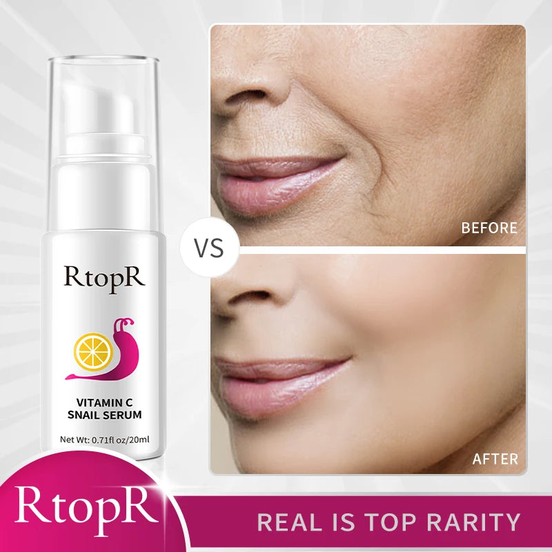 20ml Hyaluronic Vitamin-C Snail Serum