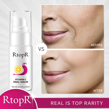 20ml Hyaluronic Vitamin-C Snail Serum