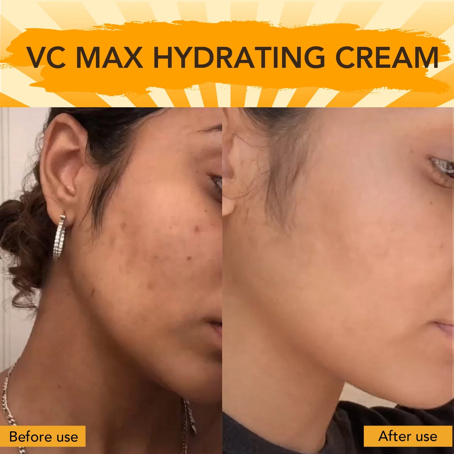 AILKE Vitamin-C Brightening Body Cream